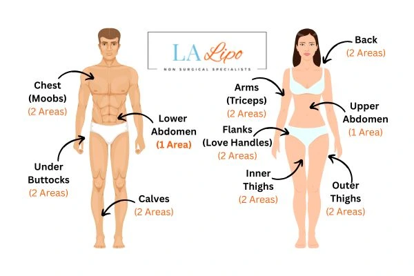 LA LIPO Cryolipolysis Areas Brighton