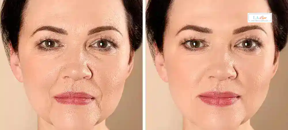 Why Aren’t My Skincare Products Making My Sagging Skin Look Firmer Brighton?