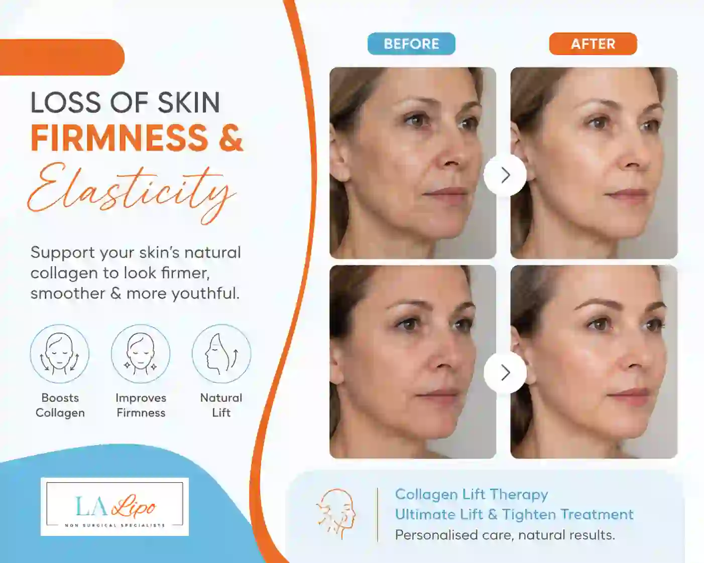Sign #7: Loss of Skin Firmness and Elasticity Brighton